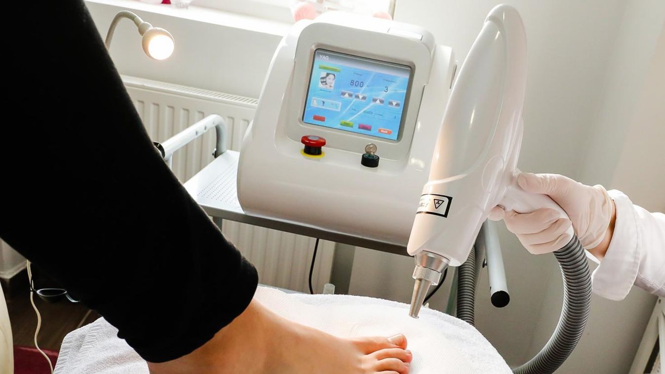 Forradalmi, fájdalommentes módszer körömgomba ellen