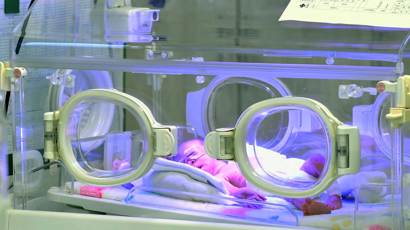 Jelentősen javultak az alig egy kilogrammal világra jött koraszülöttek életesélyei