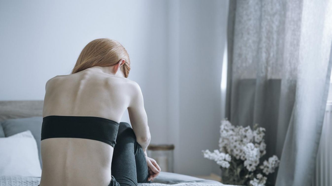 Majdnem meghalt a fiatal anorexiás lány